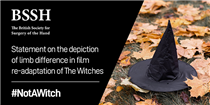 Statement on the depiction of hand deformity in 'The Witches'